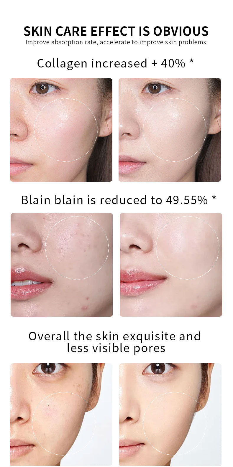 Nano microneedle non-invasive conductive beauty device