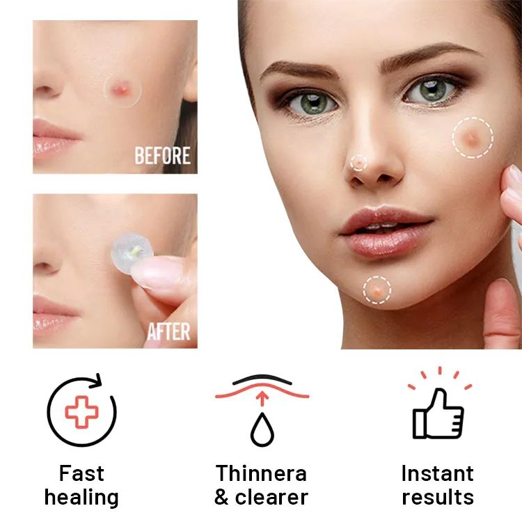 Hydrocolloid Acne Pimple Patch